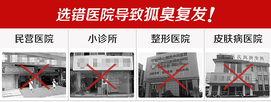 贵阳治疗狐臭医院